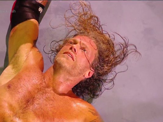 edge-backlash