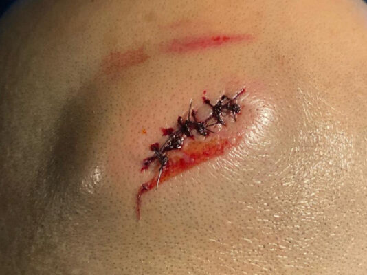 01-ricochet-wwe-friday-night-smackdown-12-23-2022-miracle-on-34th-street-fight