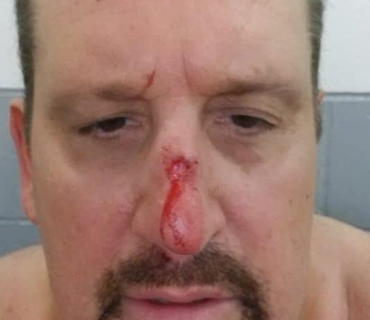 Tommy Dreamer Suffers Broken Nose During Recent Independent Wrestling Match