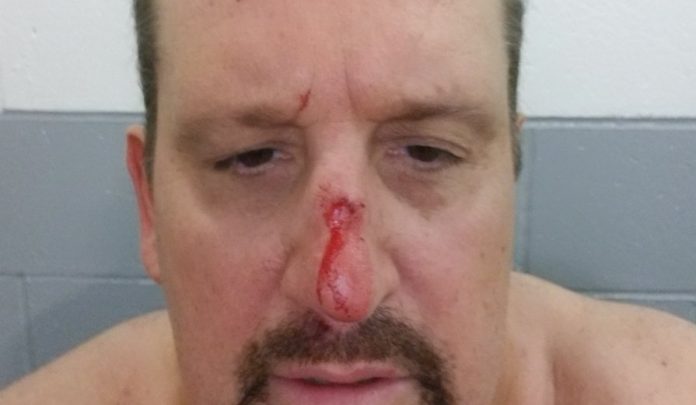 01-tommy-dreamer-broken-nose