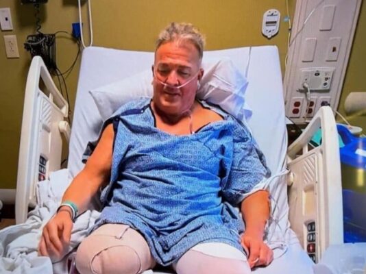 Buff Bagwell in hospital after legs amputated.