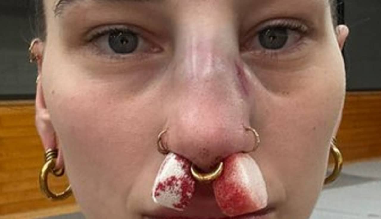 Giulia Reflects On Black Eye She Gave Rhea Ripley That Went Viral