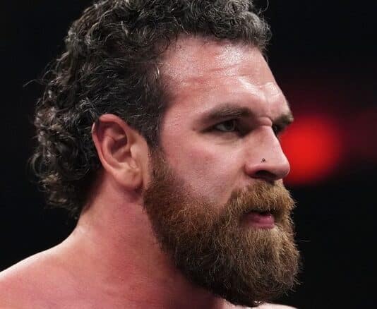 Backstage Update On Jake Doyle Being Sidelined With An Injury Jake Doyle